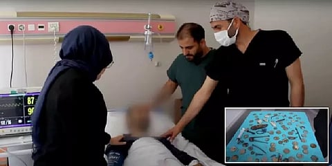 இது வயிறா? இல்ல டூல் பாக்ஸா? - நோயாளியின் வயிற்றை பார்த்து ஷாக்கான மருத்துவர்கள்!