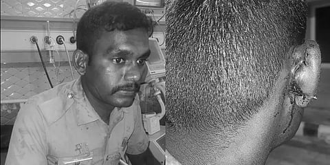 கடைத்தெருவில் கலாட்டா செய்தவரை தட்டி கேட்ட காவலர் மீது கத்தியால் தாக்குதல்!