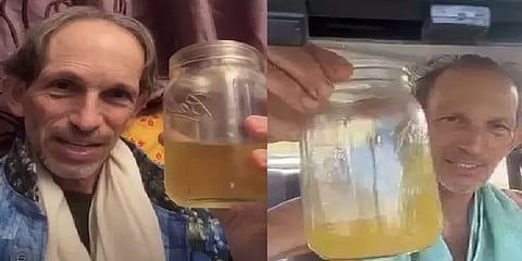 ”காலையில் எழுந்ததும் சிறுநீரைதான் குடிப்பேன்” - யூரோ தெரப்பி கொடுக்கும் இந்த நபர் யார்?