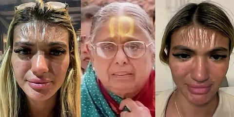 ’நீ போட்ட பத்துதான் போகல மொமண்ட்’.. சூரிய ஒளியில் படுத்துறங்கிய பெண்ணுக்கு நேர்ந்த கதி!