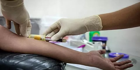 ஒரே சமயத்தில் கொரோனா, குரங்கு அம்மை, எச்ஐவி.. மூன்றும் பாதித்த உலகின் முதல் நோயாளி!