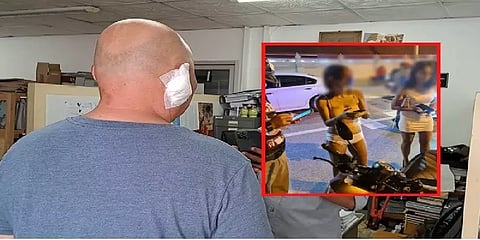 முதியவரின் காதை கடித்து முழுங்கிய பாலியல் தொழிலாளி.. பட்டாயாவில் நடந்த பகீர் சம்பவம்!