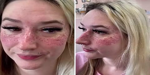 ”புள்ளி புள்ளியா இருக்குற முகம்தான் வேணும்”-விநோதமான டாட்டூக்காக 1400கிமீ பயணித்த ஆஸி பெண்