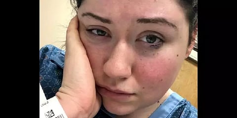 புவியீர்ப்பு விசையால் அலர்ஜி! ’3 நிமிடங்களில் மயங்கிவிழும் இளம் பெண்’ அரிய நோயால் அவதி!