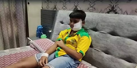 பிட்புல் நாய் கடித்துக் குதறியதில் சிறுவனின் முகத்தில் 200 தையல்கள்!