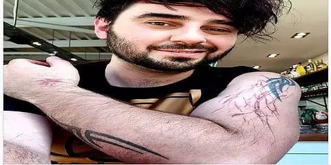 ப்ளே ஸ்டேஷனில் விளையாடிக் கொண்டிருந்தவர் மீது மின்னல் தாக்குதல் - உயிர்பிழைத்த அதிசயம்