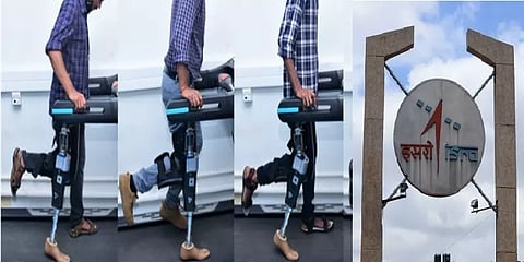 மாற்றுத் திறனாளிகளுக்கு மைக்ரோ சிப் பொருத்தப்பட்ட செயற்கை கால்- இஸ்ரோ வடிவமைப்பு