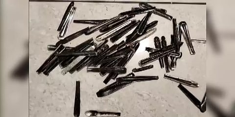 பசி எடுக்கும்போது ஸ்பூன்களை சாப்பிட்ட இளைஞர்?! 62 ஸ்பூன்களை போராடி அகற்றிய மருத்துவர்கள்!