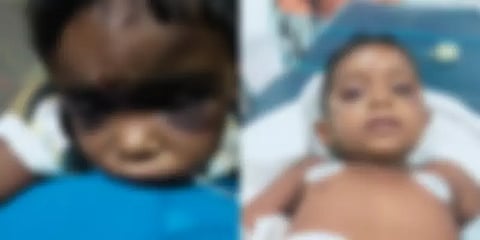 குடிபோதையில் 2 வயது குழந்தைக்கு சிகரெட்டால் சூடுவைத்த கொடூர தாய்! சென்னையில் பயங்கரம்