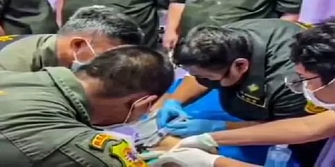 அளவை பெரிதாக்க நினைத்து ஆணுறுப்பில் மெட்டல் ரிங் மாட்டியவருக்கு நேர்ந்த விபரீதம்!