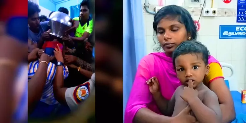 குழந்தை தலையில் சிக்கிய பாத்திரத்தை 1 மணி நேரம் போராடி வெட்டி அகற்றிய மருத்துவர்கள்