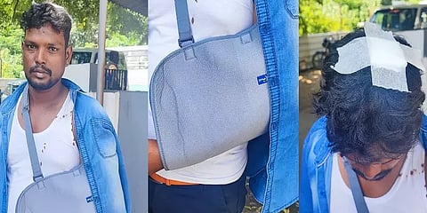 டெமோ ஆடை விற்பனையகத்தில் புகுந்த கொள்ளையர்கள் - ஊழியருக்கு கத்திக்குத்து