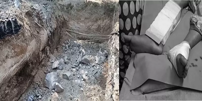 அனுமதியின்றி சாலையில் வைக்கப்பட்ட வெடி... பெண் கூலித்தொழிலாளிக்கு 2 கால்களிலும் பாதிப்பு