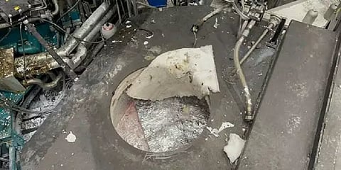 720 டிகிரி செல்ஷியஸ் அலுமினியம் டப்பில் விழுந்த நபர் - உயிர்பிழைத்த அதிசயம்