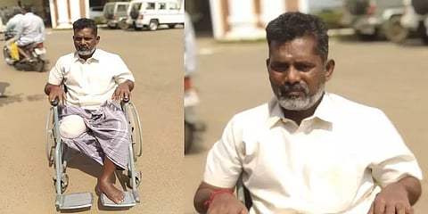 ’தவறான சிகிச்சையால் காலை இழந்தேன்; இந்தநிலை யாருக்கும் வரக்கூடாது’ - பஸ் டிரைவர் கண்ணீர்