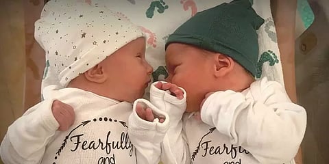 ’உலகின் வயதான குழந்தைகள்’ - 30 ஆண்டுகளுக்குமுன் பதப்படுத்தப்பட்ட கருவிலிருந்து ட்வின்ஸ்!