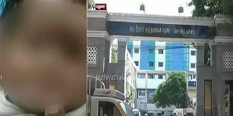 குழந்தையின் நாக்கிற்கு பதிலாக பிறப்புறுப்பில் அறுவைச் சிகிச்சை-மதுரையில் நடந்தது என்ன?