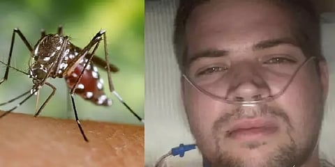 30 ஆபரேஷன், 4 வார கோமா என இளைஞரின் வாழ்க்கையை புரட்டிப்போட்ட ஒரு கொசு.. நடந்தது என்ன?