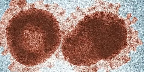 புத்துயிர் பெற்றதா 48,500 வருட பழமையான ஜாம்பி வைரஸ்? - எதிர்காலத்தில் என்னவாகும்?