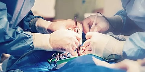 இது என்ன வகை நோய்? - 50 வயது பெண்ணின் 12 கிலோ கல்லீரலை நீக்கி மருத்துவர்கள் சாதனை