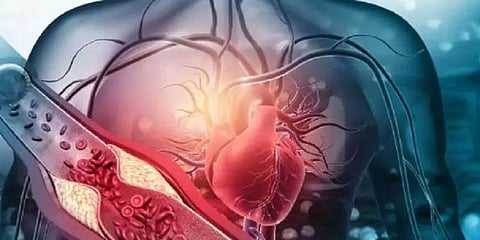 இந்த அறிகுறிகள் தென்படுகிறதா? - உங்கள் ரத்தக்குழாய்களில் அடைப்பு என்று அர்த்தமாம்!