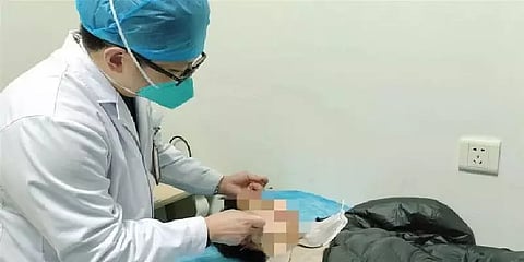 ”விடிய விடிய ஃபுட்பால் பார்த்தேன்; இப்படியாகும்னு நினைக்கல” Facial Palsyயால் பாதித்த சீனர்