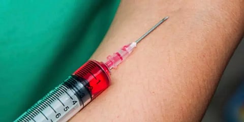 ”விவாகரத்துக்கு காரணம் தேடி..” - கர்ப்பிணி மனைவிக்கு HIV ரத்தத்தை செலுத்திய கொடூர கணவன்