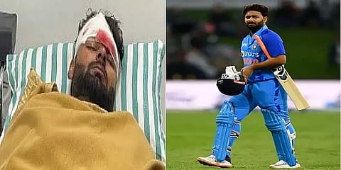 முகக் காயத்திற்கு பிளாஸ்டிக் அறுவை சிகிச்சை! வெளியான ரிஷப் பண்ட்-ன் எம்ஆர்ஐ முடிவுகள்!