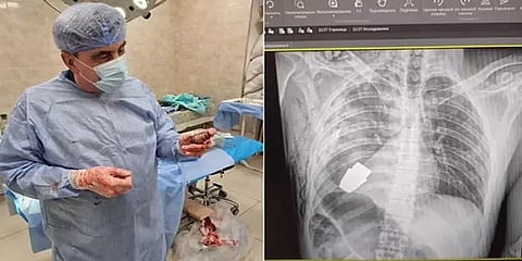 உக்ரைன் ராணுவ வீரரின் மார்பை துளைத்த கையெறி குண்டு - உயிரை பணயம் வைத்து அகற்றிய மருத்துவர்