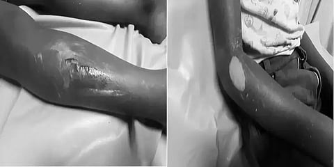 7 வயது மகனுக்கு பழுத்த கம்பியால் சூடு! கண்ணில் மிளகாய் பொடி தேய்த்து தண்டனை-இதற்கா இப்படி?