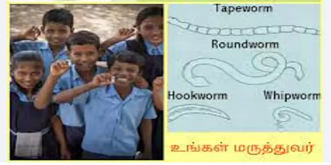 தேசிய குடற்புழு நீக்க வாரம்: கல்வி நிலையங்களில் மாத்திரைகள் கொடுக்க என்ன காரணம்?