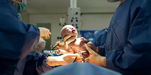குழந்தையா? இதயமா? - ஒரேநேரத்தில் இரு அறுவைசிகிச்சைகளை நிகழ்த்தி லக்னோ மருத்துவர்கள் சாதனை!