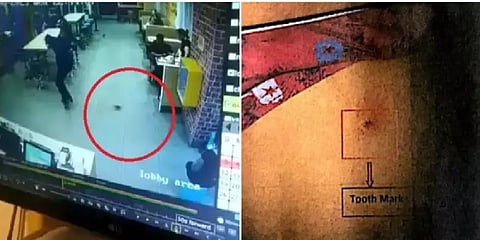 பர்கர் சாப்பிட்டுக் கொண்டிருந்த சிறுவனை கடித்த எலி: மெக்டோனல்ஸ் உணவகம் மீது பாய்ந்த புகார்