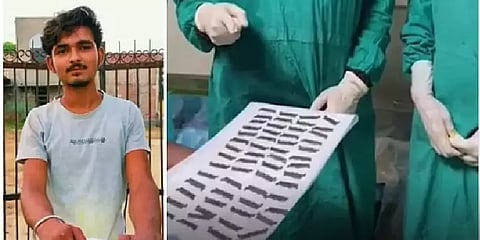 ரத்த வாந்தி என வந்த இளைஞரின் வயிற்றில் இருந்த பிளேடுகள்.. அதிர்ந்துப்போன மருத்துவர்கள்!