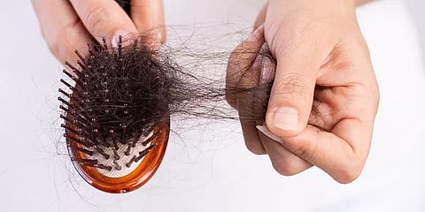 அதிகம் முடி கொட்டுகிறது என்று உணர்கிறீர்களா? - இந்த 60 நொடி டெஸ்ட் போதும்!