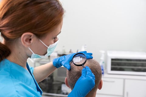 Exploring the Range of Hair Loss Treatments Available at Hair Loss Clinics