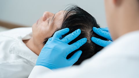 Thinking About a Hair Transplant? Here’s Why Istanbul Leads the Way