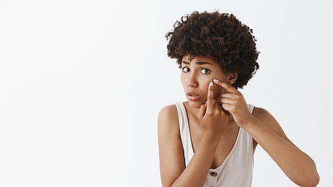 Woman examining under-eye dark circles before applying concealer on dark skin tone
