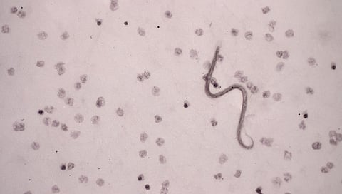 चिंताजनक ! भंडारा जिल्ह्यात कोरोना नव्हे तर वाढतोय 'हा'आजार