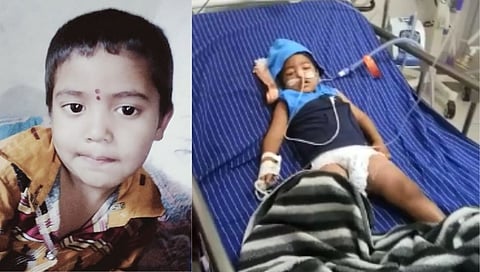 बीडच्या रिक्षा चालकाच्या चिमुकल्या मुलाची मेंदूच्या आजारासह निमोनियाशी झुंज