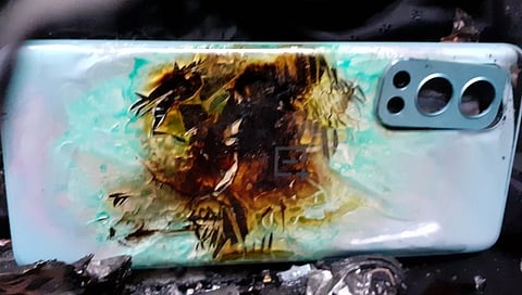 One Plus च्या स्मार्टफोनचा खिशात स्फोट; तरुण जखमी