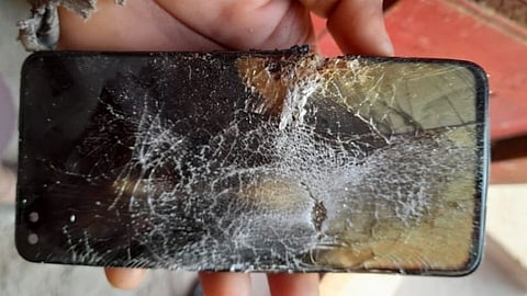Sangli OnePlus ब्लास्ट प्रकरण: खिशात मोबाईलचा स्फोट झाल्याने तरुण जखमी