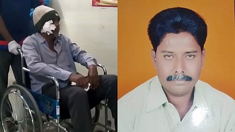 गोंदियातील सामाजिक कार्यकर्त्यावर अज्ञाताकडून गोळीबार!