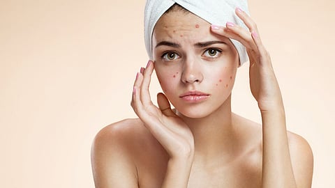 Health tips, Menstrual period, Skin care