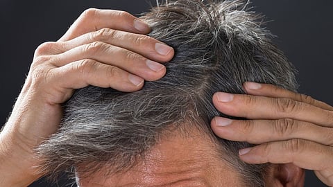 Hair care tips, Hair care tips for men, Hair falls problem