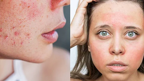 Makeup Mistake, Skin Care Tips, Skin Health
