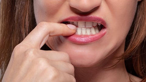 Yellow Nail, Health Tips