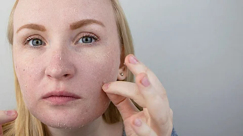 Itchy & Dry Skin