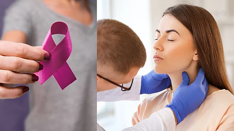 Thyroid Cancer