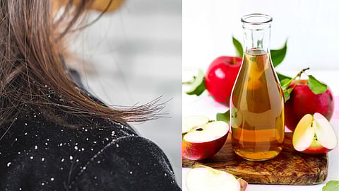 Winter Hair Care